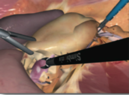 Simbionix LAP Mentor Laparoscopy Nephrectomy Module